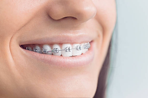 Best Dental Inlays and Onlays  in Fayette, LA
